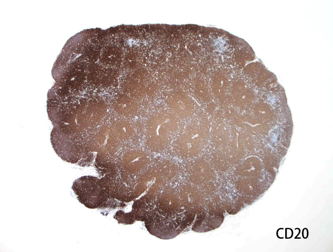 CD20-1.jpg