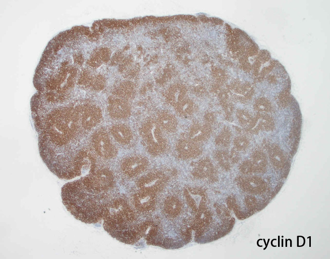 cyclinD1-1.jpg