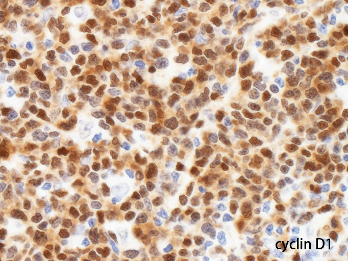 cyclinD1-2.jpg