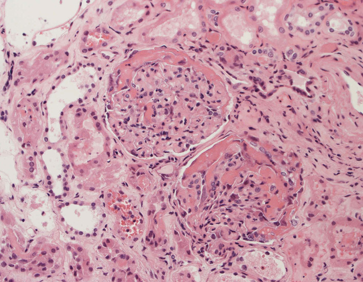kidney01.jpg