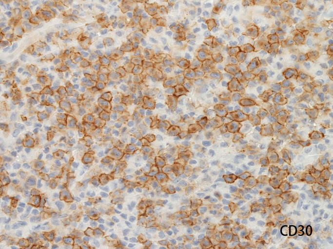 CD30b_01.jpg