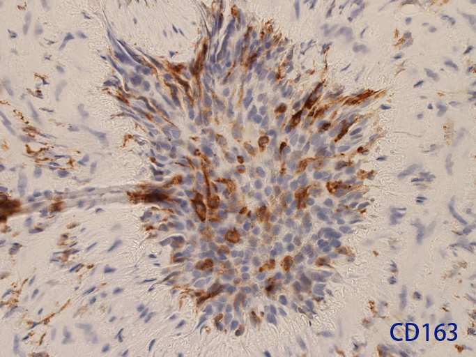CD163.jpg