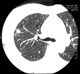 CT01HE.jpg