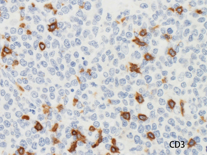CD3-2.jpg