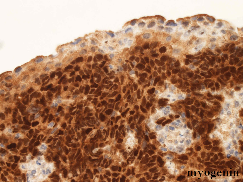 myogenin_01.jpg