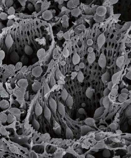 spleen-red pulp-EMok.jpg